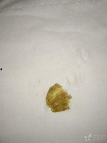 胆脂瘤图片,胆脂瘤影像学特征解析与临床诊断要点