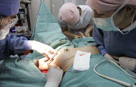 日本 隆胸,重塑美丽与自信的奇迹之旅