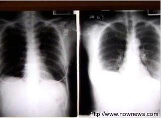 甲型图片,探寻其背后的故事与意义