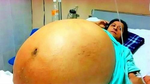 大肚子要生了视频,温馨记录生命诞生的瞬间