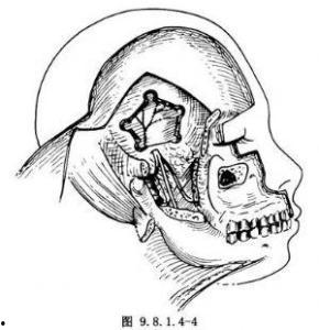 颞下窝的位置图片,人体解剖学中的关键结构