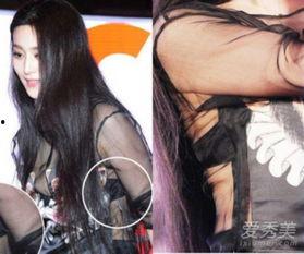 胳膊破了图片大全,常见胳膊伤口处理技巧解析