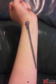 胳膊破了图片大全,常见胳膊伤口处理技巧解析