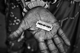 非洲女孩割礼图片大全,揭开神秘面纱的残酷现实