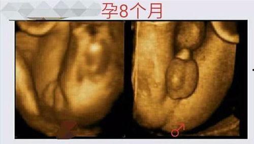 怀孕八个月胎儿图片大全,见证生命奇迹的瞬间
